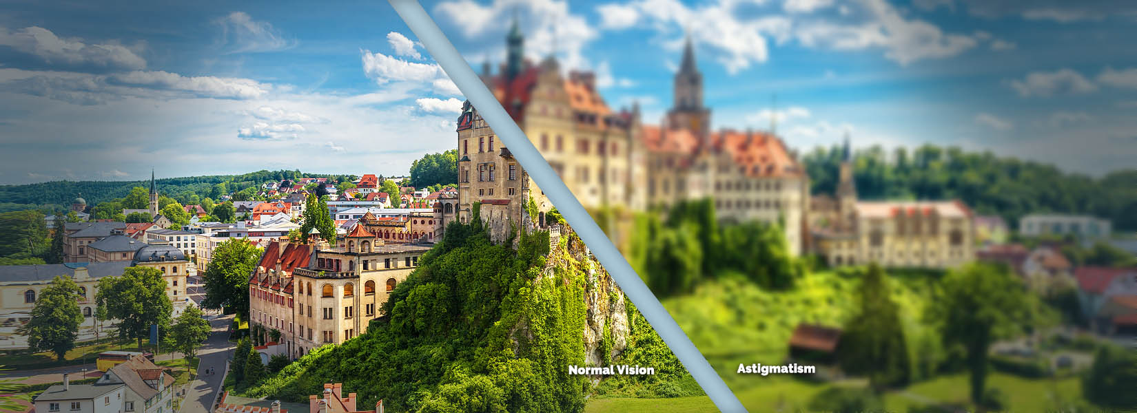 Astigmatism Treatment in St. Louis Hills