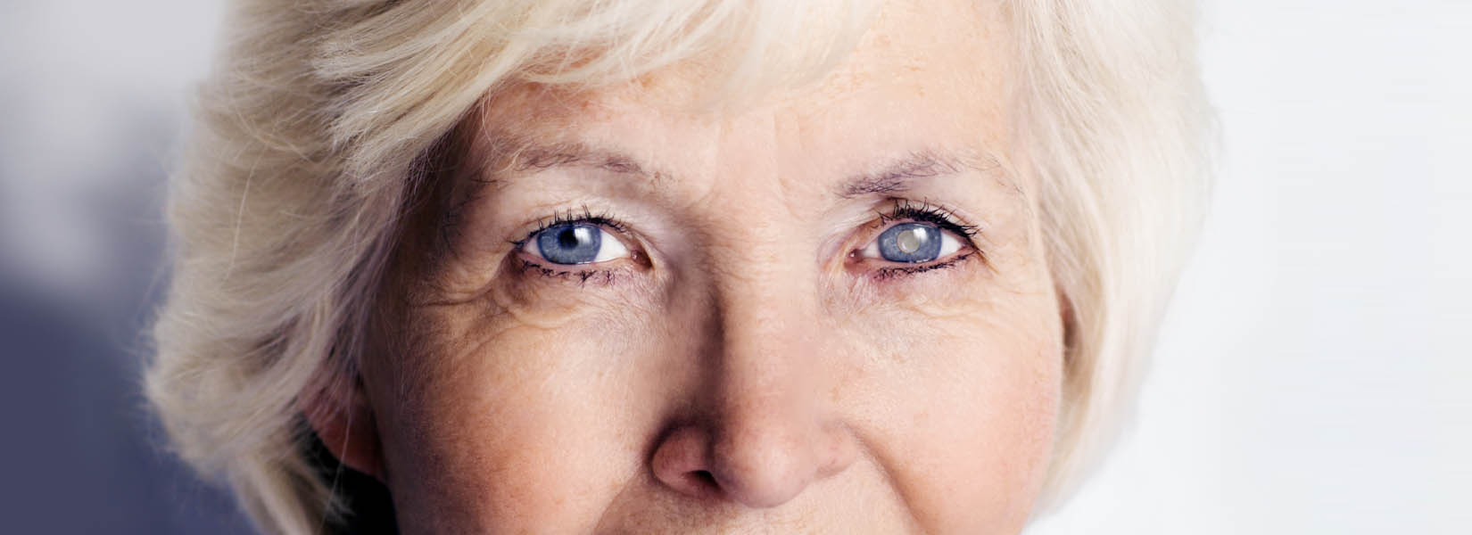 Cataract Surgery in St. Louis Hills